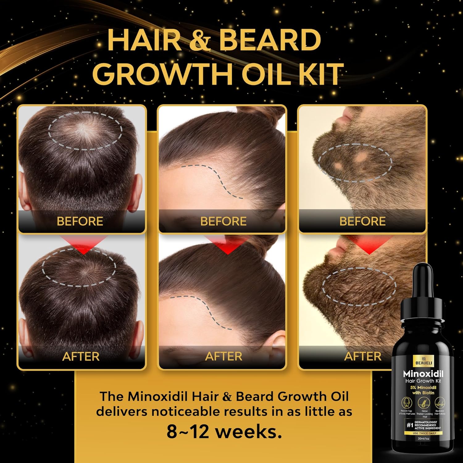 Beaueli 5% Topical Minoxidil Serum Kit - 30ml + Roller